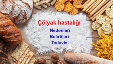 Photo of Çölyak Hastalığı Nedir?