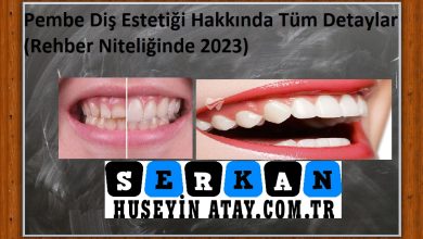 Photo of Pembe Diş Estetiği Hakkında Tüm Detaylar (Rehber Niteliğinde 2023)
